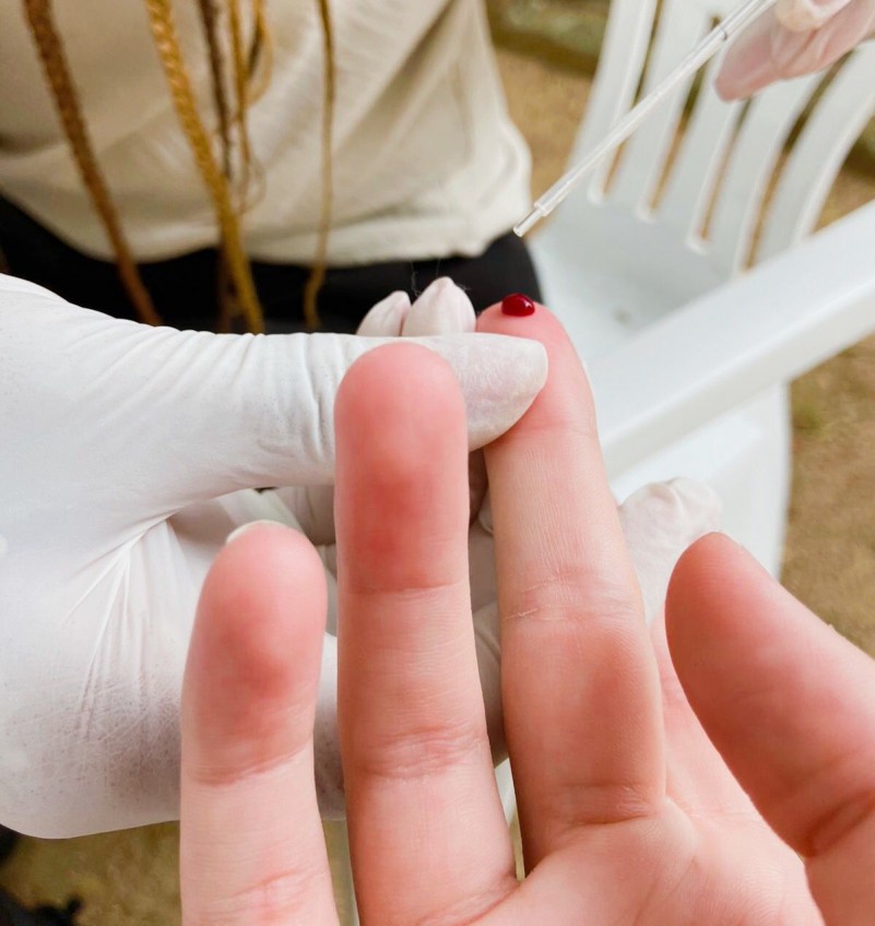 Teste rápido HIV